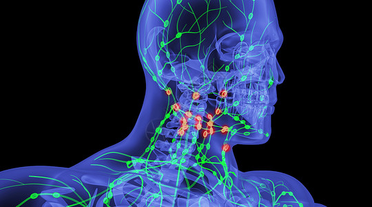 颈部淋巴结人体淋巴病变场景设计图片