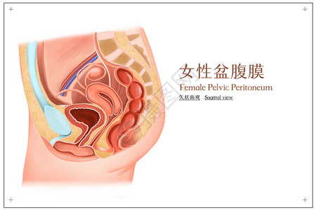 盆腔积液女性盆腹膜矢状面观插画