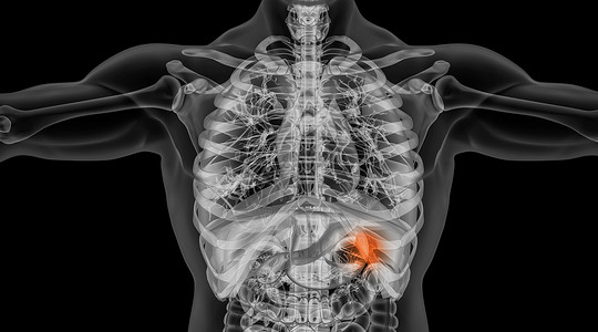 骨骼保健X光人体脾脏场景设计图片