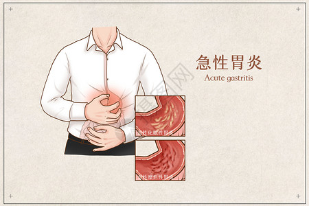急性胃炎医疗插画图片