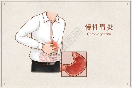 胃部检查慢性胃炎医疗插画插画