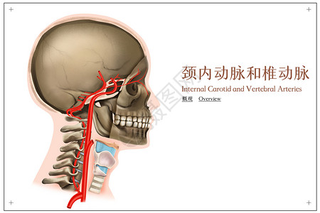 颈内动脉和椎动脉的概观医疗插画图片