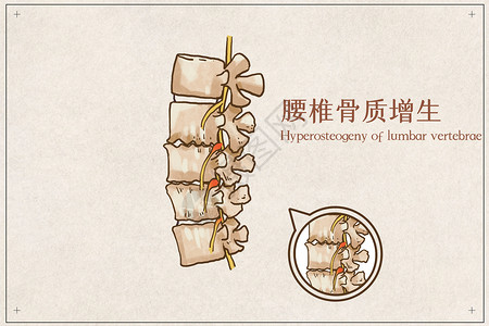 腰椎按摩腰椎骨质增生插画