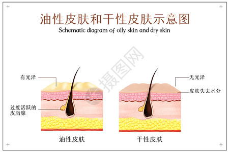 干性肌肤油性皮肤和干性皮肤示意图插画