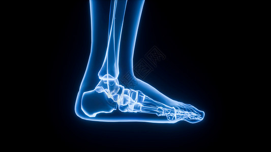 足部矫形器3D足部场景设计图片