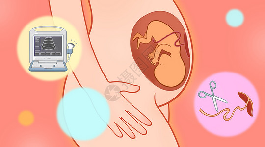 b超图片女性孕期医疗健康卡通插画插画
