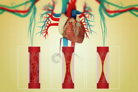 心脏疾病调节血脂高清图片
