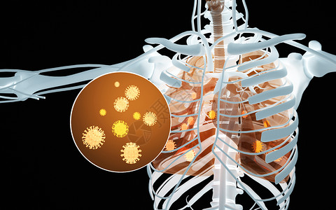 肺片肺部病毒病变设计图片