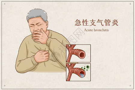 急性支气管炎医疗插画图片