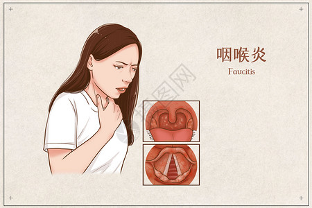 咽喉炎医疗插画图片