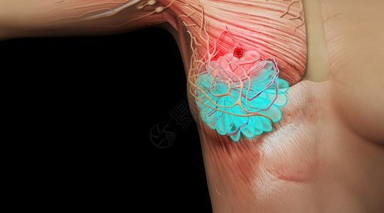 乳腺癌3d纹身素材高清图片