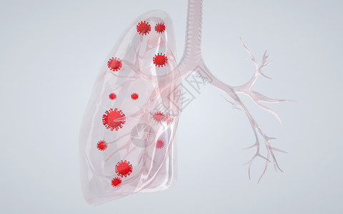 肺部肿瘤人体肺部病变感染设计图片