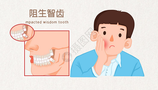 阻止智齿牙周炎医疗插画高清图片
