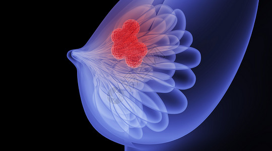 乳腺癌场景胸腔心脏高清图片