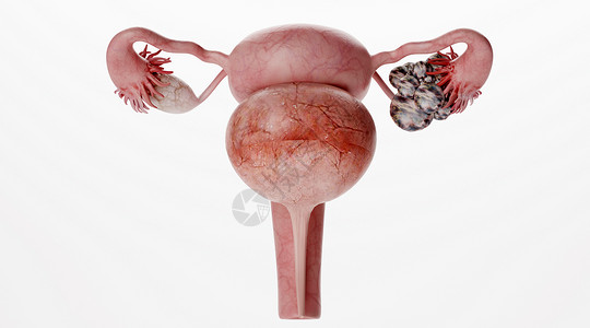 子宫收缩卵巢病变场景设计图片