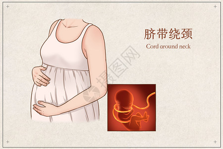 胎儿监测脐带绕颈医疗插画插画