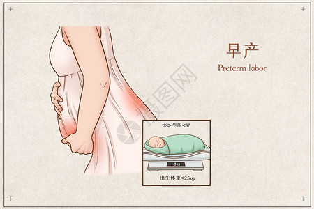 孕妇看病早产医疗插画插画