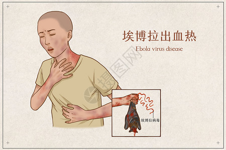 埃博拉出血热医疗插画插画