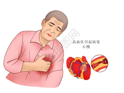 心脏疾病高血压心梗医疗插画插画