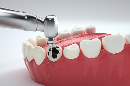 牙齿缺失C4D修补的高清图片