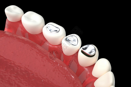 牙齿立体素材牙齿矫正场景设计图片