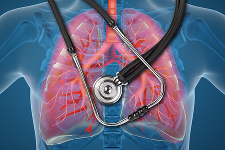 x光设备肺部疾病设计图片