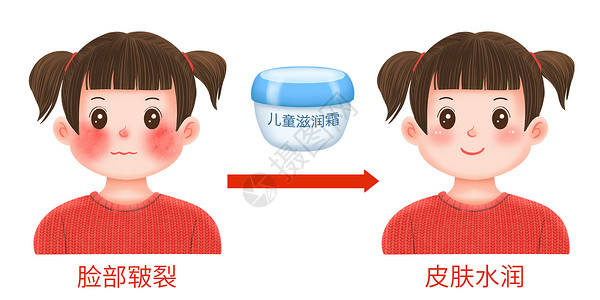 儿童护理冬天预防脸春脸皲裂插画