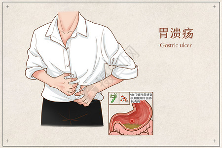 胃溃疡医疗插画图片