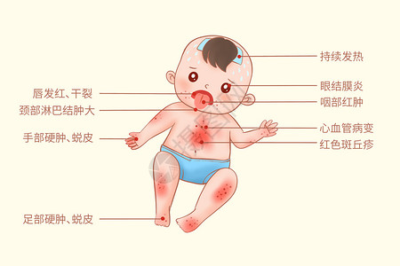 麻疹疫苗麻疹皮肤病发病症状医疗插画插画