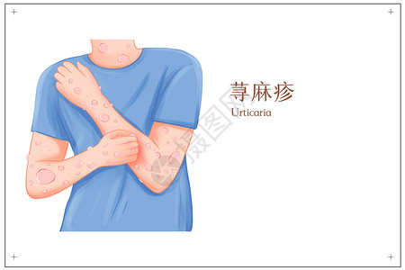 皮肤病过敏性荨麻疹医疗插画高清图片