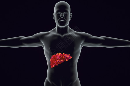 肝部病变肝脏细胞高清图片