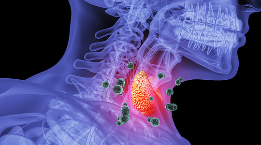 喉咙不舒服人体甲亢场景设计图片