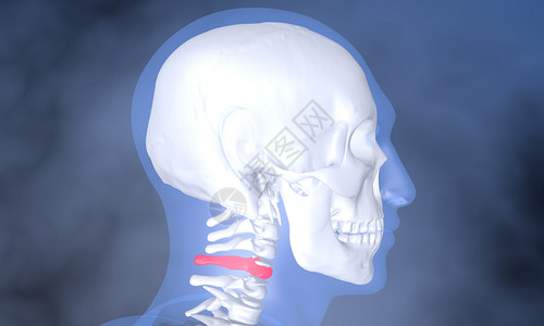 颈部骨骼病灶高清图片