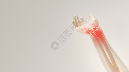 手腕酸痛C4D腱鞘炎场景设计图片