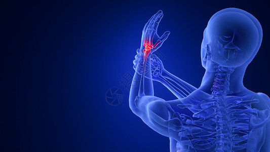 手放在肩膀上3D手腕关节疾病设计图片
