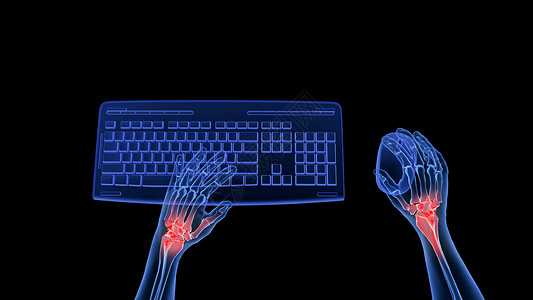 肢体肿胀3D职业病腱鞘炎设计图片