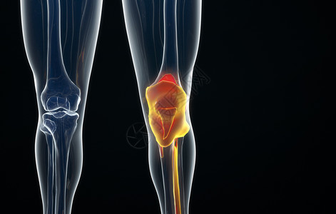 脚踝扭伤人体半月板疾病设计图片