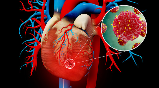 C4D心人体心脏疾病场景设计图片