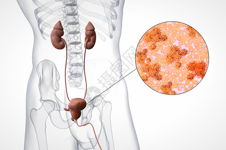 人体膀胱剖面膀胱炎症设计图片