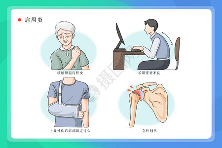 囊性纤维变性肩周炎病因医疗插画插画