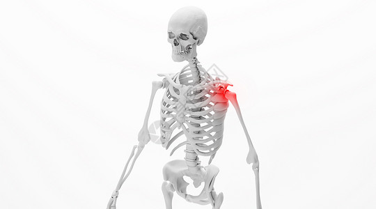 骨膜炎人体肩周炎场景设计图片
