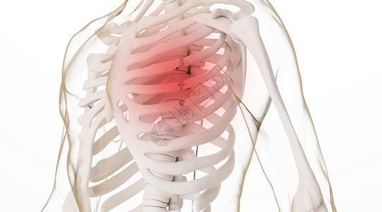 角质层受损胸部肋骨骨折场景设计图片