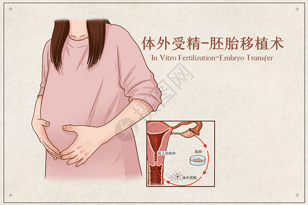体外受精胚胎移植术医疗插画背景图片