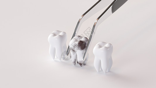 人体牙菌斑疾病C4D蛀牙场景设计图片