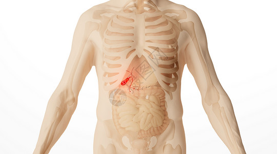肥胖人素材人体胆结石场景设计图片