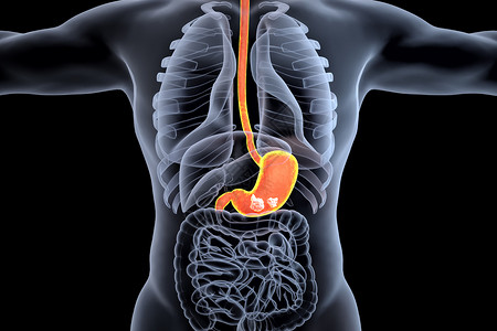 萎缩性胃炎胃部肿瘤场景设计图片