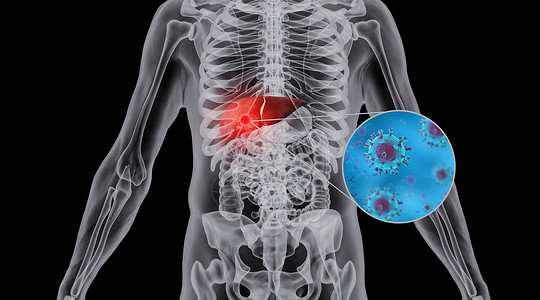 肝脏细胞人体肝部肿瘤场景设计图片