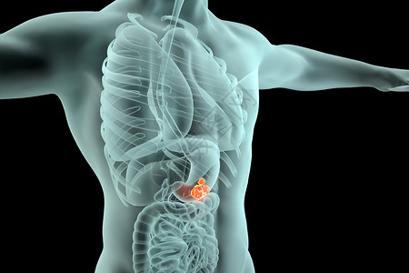 胃肠镜检查胃部肿瘤场景设计图片