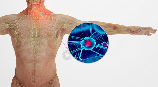 淋巴疏通人体淋巴瘤场景设计图片