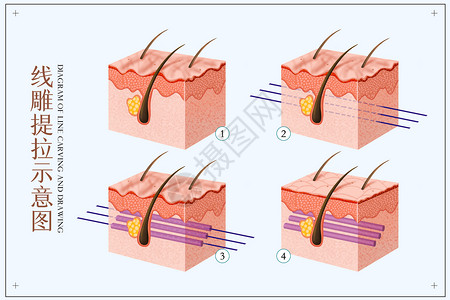 美容线雕线雕提升面部医美配图插画